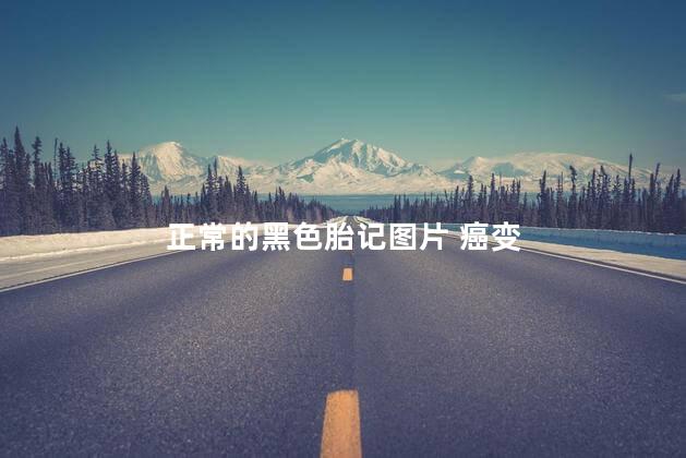 正常的黑色胎记图片 癌变